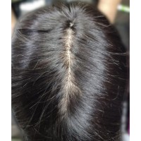 Australian Mirage Hair patch Delhi