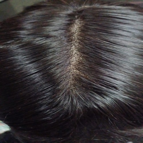 Hair Patch In Delhi  Hair Patch For Men  Radiance Hair Studio