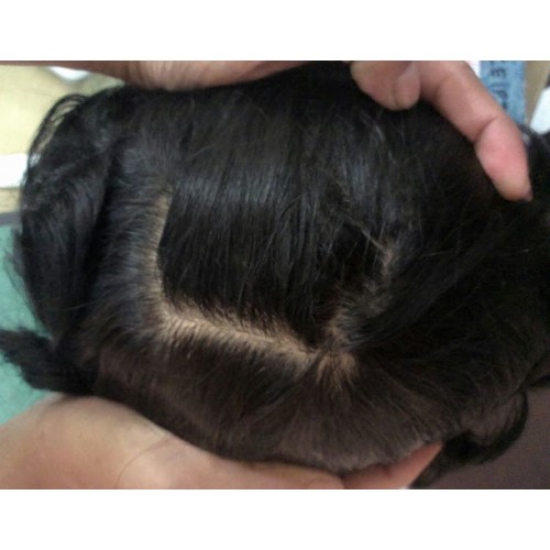 Miraj Front lace Hair Patch